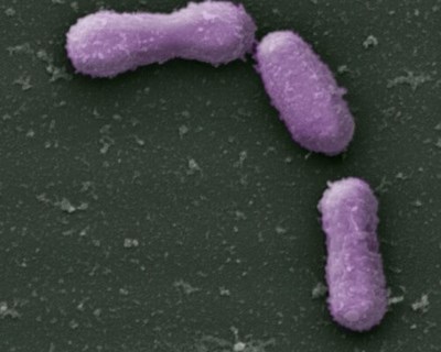 Autorização Novo Alimento: Akkermansia muciniphila pasteurizada