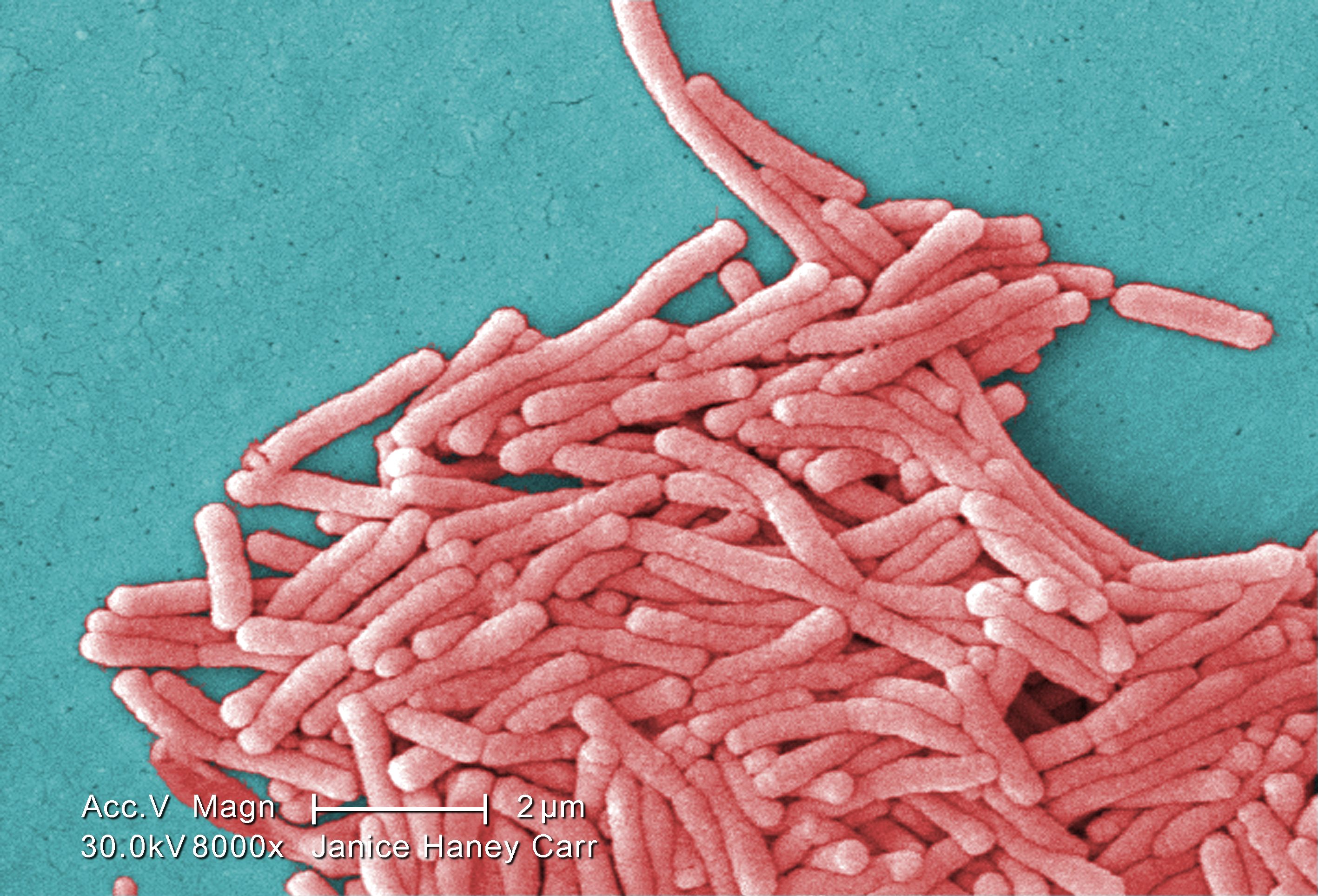 Legionella